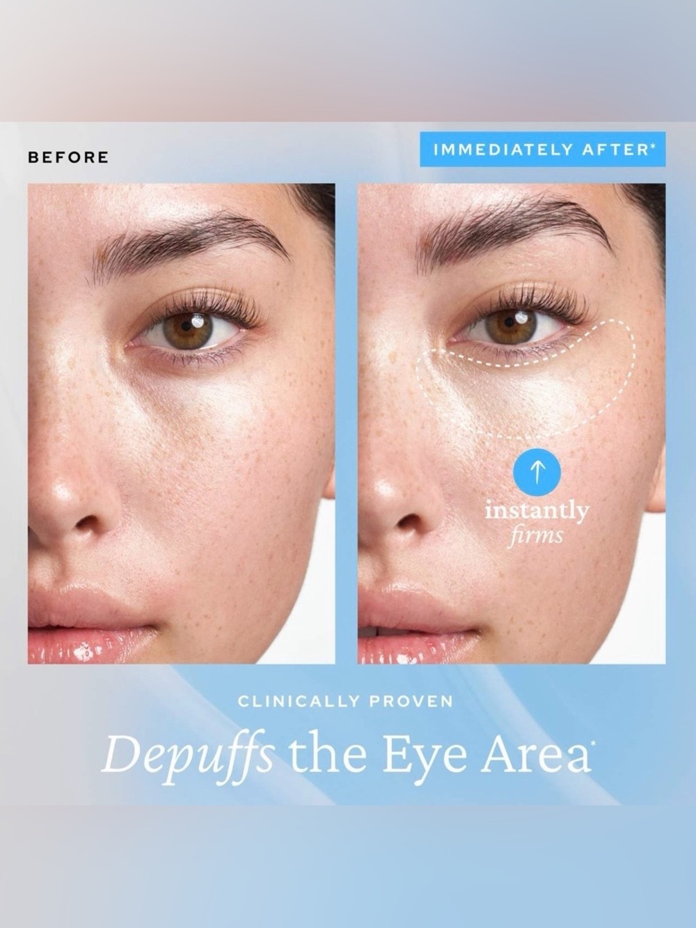 💦 BELIF Aqua Bomb Eye Gel - Picture 10 of 12